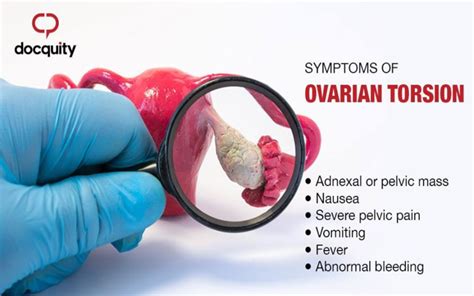 ovarian contortion|how to diagnose ovarian torsion.